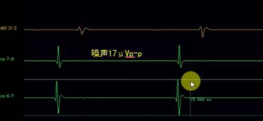 QQ截圖20190108152118.png QQ截圖20190108152118.png